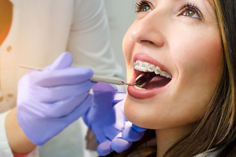 10 Common Orthodontic Myths Busted