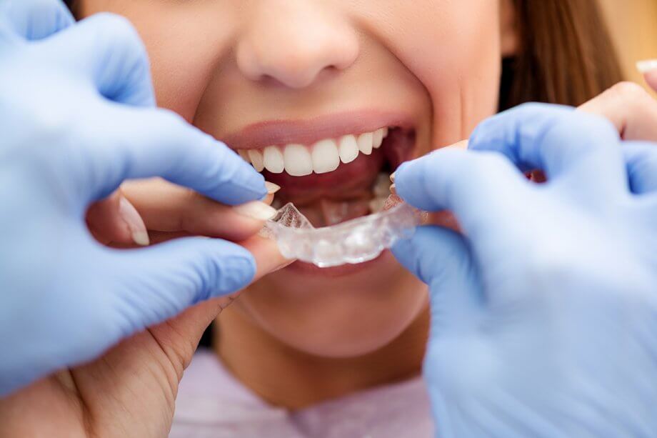 How Much Does Invisalign Cost in Greenwich, CT?