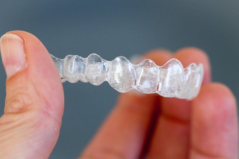 What Is Invisalign?